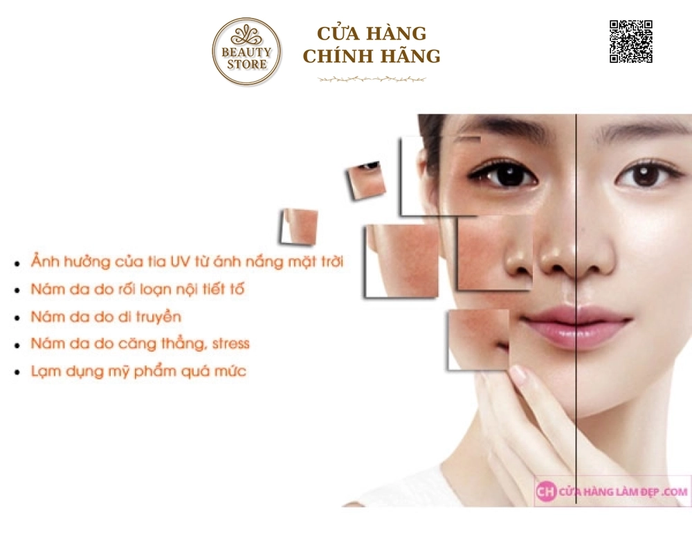 Kem Mờ Nám, Trắng Da An Toàn Wcare With Nano